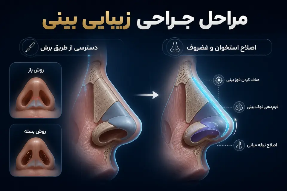 مراحی جراحی زیبایی بینی