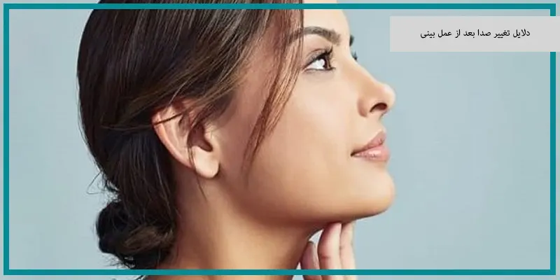 دلایل تغییر صدا بعد از عمل بینی