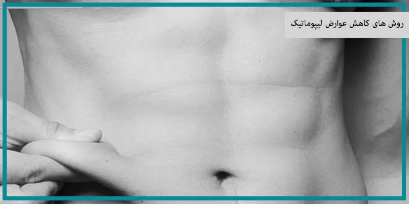 روش های کاهش عوارض لیپوماتیک