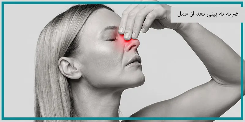 ضربه به بینی بعد از عمل