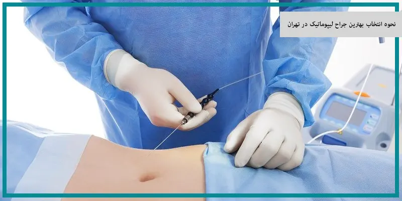 نحوه انتخاب بهترین جراح لیپوماتیک در تهران