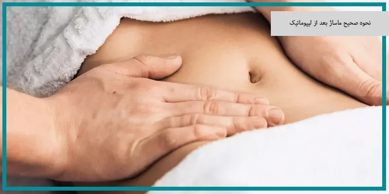 نحوه صحیح ماساژ بعد از لیپوماتیک