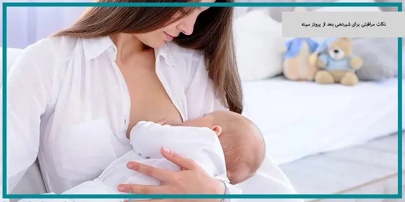 نکات مراقبتی برای شیردهی بعد از پروتز سینه