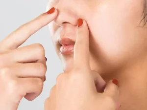 چربی پوست بینی بعد از عمل